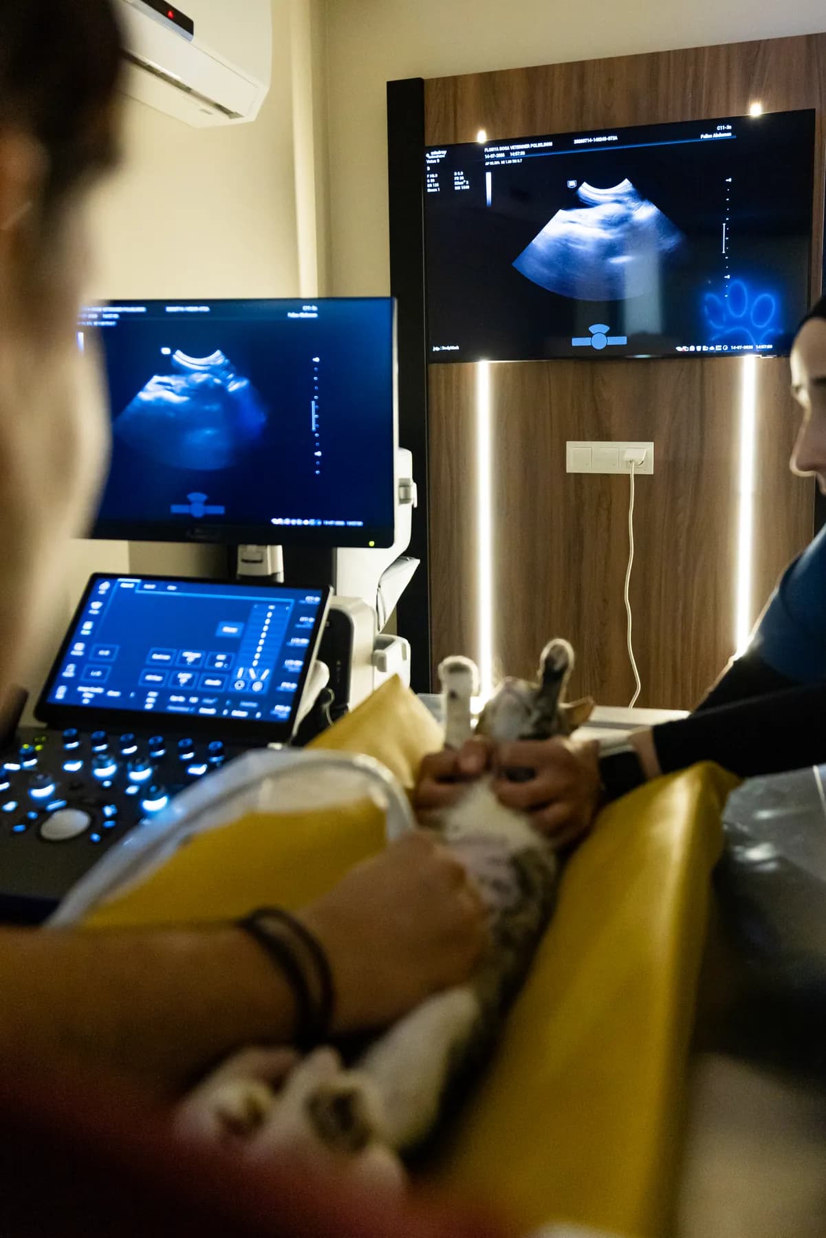 Ultrasonografi